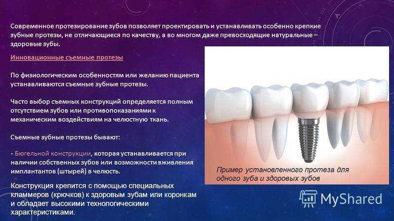 Съемные зубные протезы: фото, лучшие съемные зубные протезы, как привыкнуть