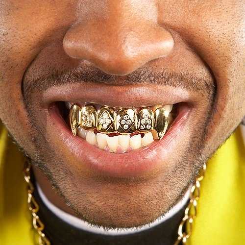 Модное украшение на зубах: грилзы – стоматология президент